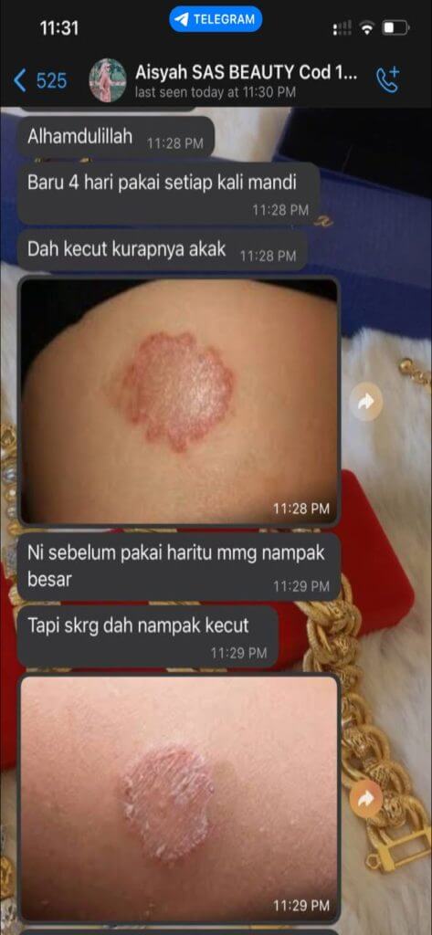 testimoni sabun herba al-idrus