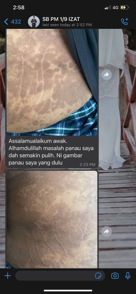 testimoni sabun herba al-idrus